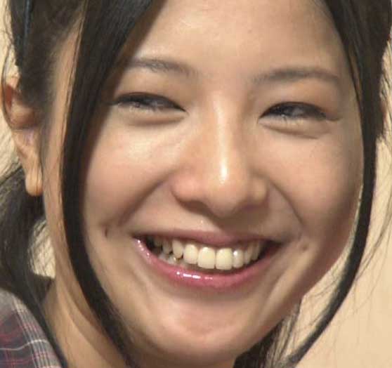 吉高由里子の歯が黄色はタバコ 歯並び治して前歯は差し歯の噂 画像 オモシロゴト